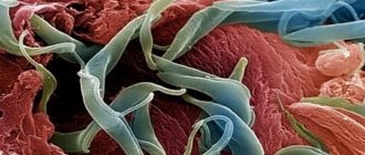 Photo of worms in the human body (symptoms and description)