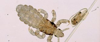 Head louse: nutrition, lifestyle, habitats